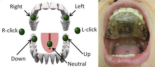 Manyetik diş teli ile dilinizi kullanarak cihazları yönetebileceksiniz