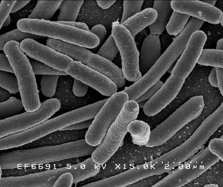 Bakterilerin antibiyotik direncine karşı ümit verici gelişme!