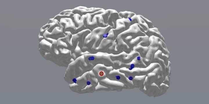 Beynin elektrikle uyarılması hafızayı geliştiriyor 