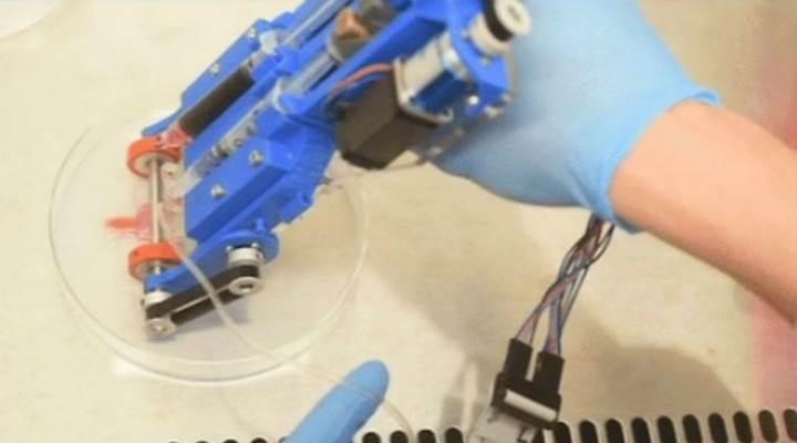 Yanık ve yara tedavisinde devrimsel buluş: Taşınabilir 3D deri yazıcısı