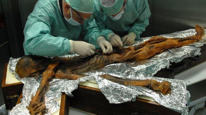 Buzul içerisinde mumyalanmış Buzadam Ötzi'nin son yemeği teşhis edildi