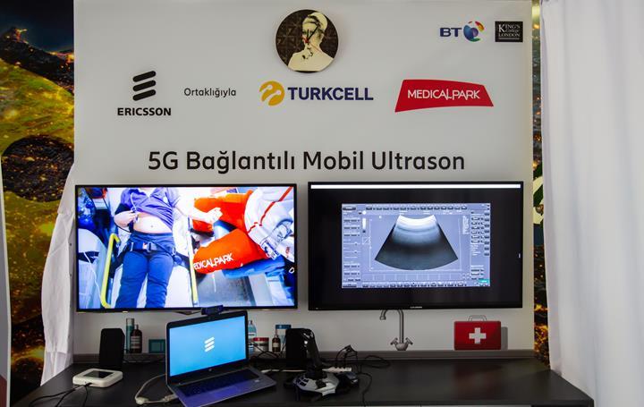 Turkcell, 5G üzerinden uzaktan ultrason taraması yaptı