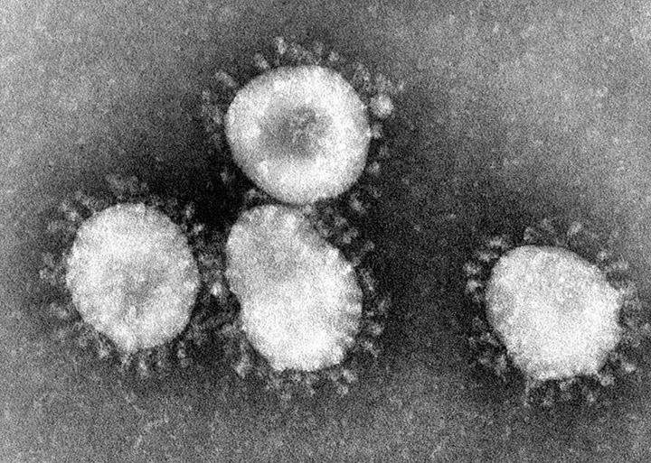 Coronavirüs nedir ?