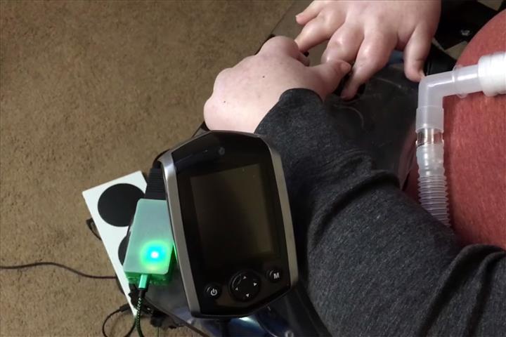 Yeni bir Xbox adaptörü, tekerlekli sandalyeleri oyun kumandalarına dönüştürmeyi sağlıyor