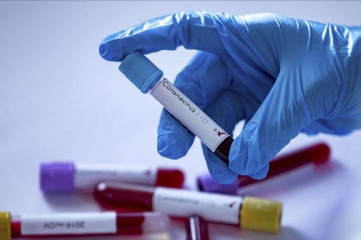 Sağlık Bakanlığından koronavirüs test sonuçlarına ilişkin açıklama