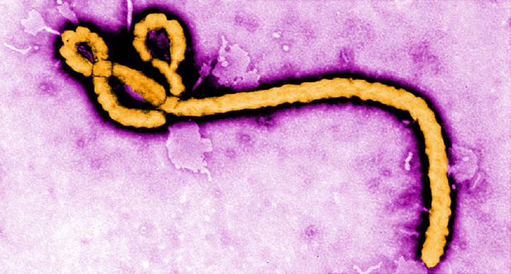 Tüm Ebola türlerine karşı kullanılabilecek bir aşı geliştiriliyor