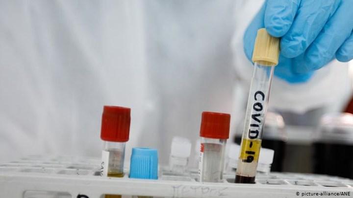 İlk insanlı koronavirüs aşı denemesini yapan ABD’li Moderna: “İlk sonuçlar umut verici”