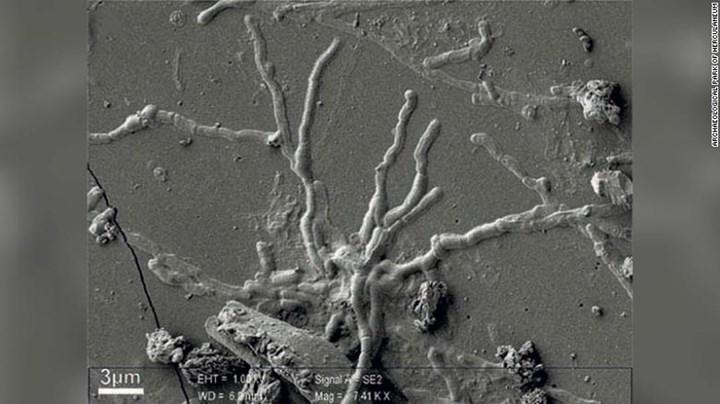 M.S. 79 yılında Vezüv patlamasında ölen adamın beyninde, sağlam hücreler bulundu