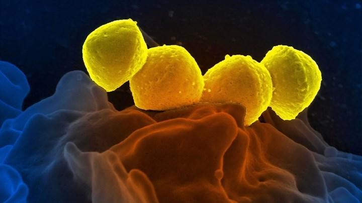 Antibakteriyel özelliğe sahip selüloz içeren membran geliştirildi