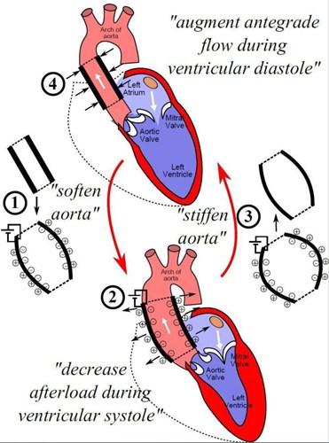 Yapay aorta geliştirildi