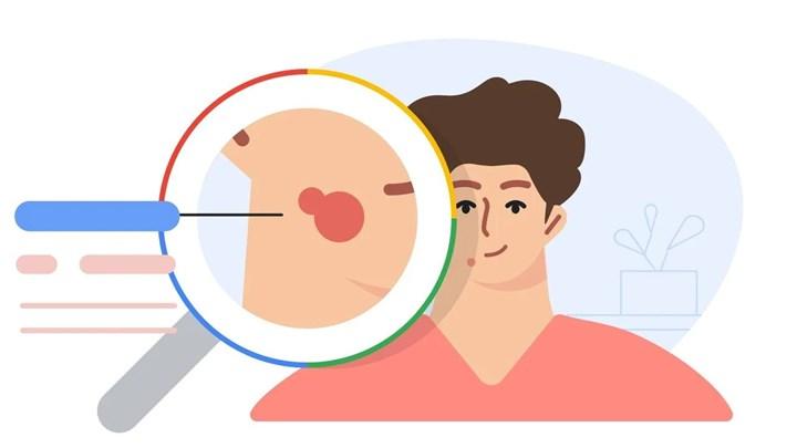 Google'dan cilt hastalıklarını tespit edebilen yapay zeka