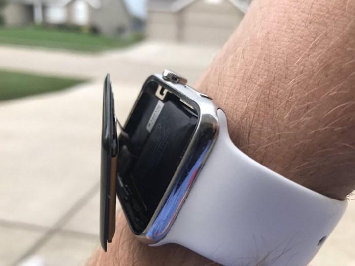 Apple Watch 6 kullanıcılarından Apple'a toplu dava