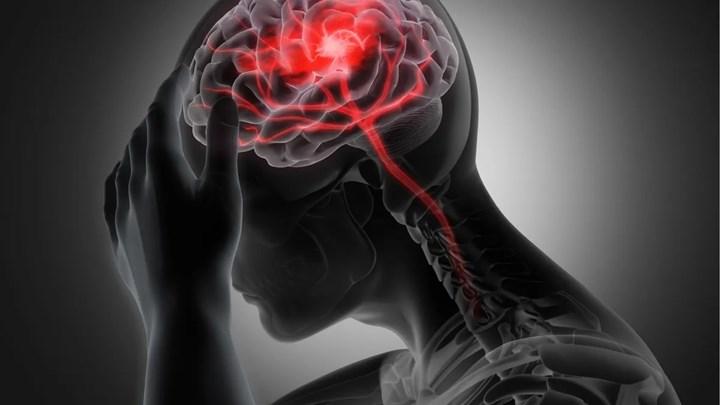 migren ve seker arasinda bir iliskinin oldugu bulundu160927 0