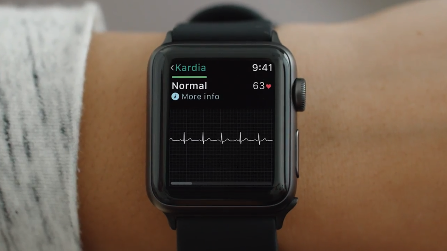 Apple Watch 4’ün EKG özelliği nedir? Nasıl kullanılır?