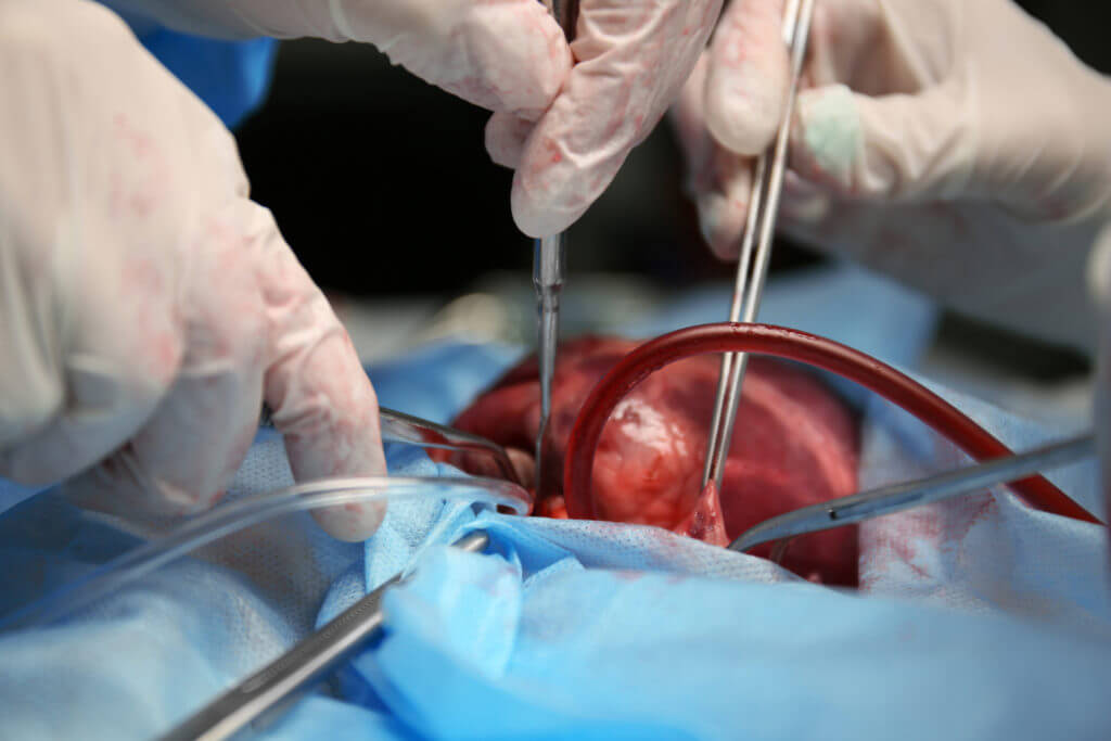 Aynı donörden organ nakledilen dört kişi de kansere yakalandı