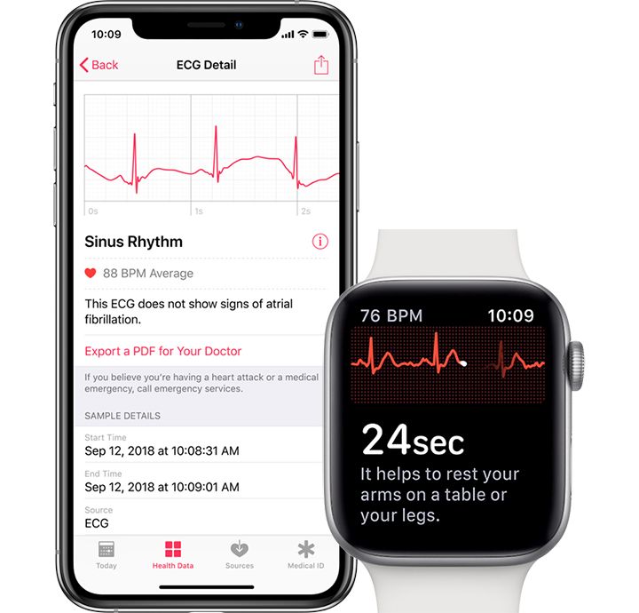 Apple Watch 4'e EKG özelliği watchOS 5.1.2 güncellemesi ile gelebilir