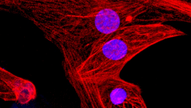 CRISPR sayesinde organ nakilinde doku reddi tarih olacak