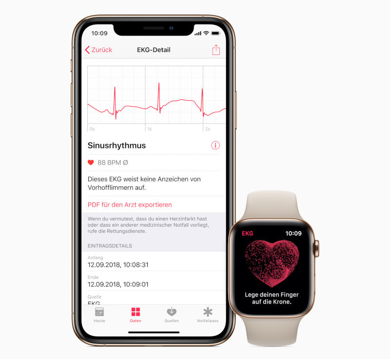 Apple Watch EKG özelliği Avrupa’ya geliyor