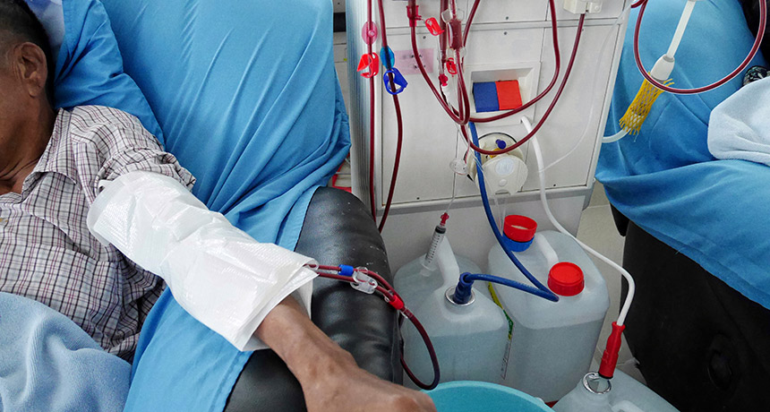Laboratuvar ortamında geliştirilen kan damarları, diyaliz işlemini kolaylaştırabilir