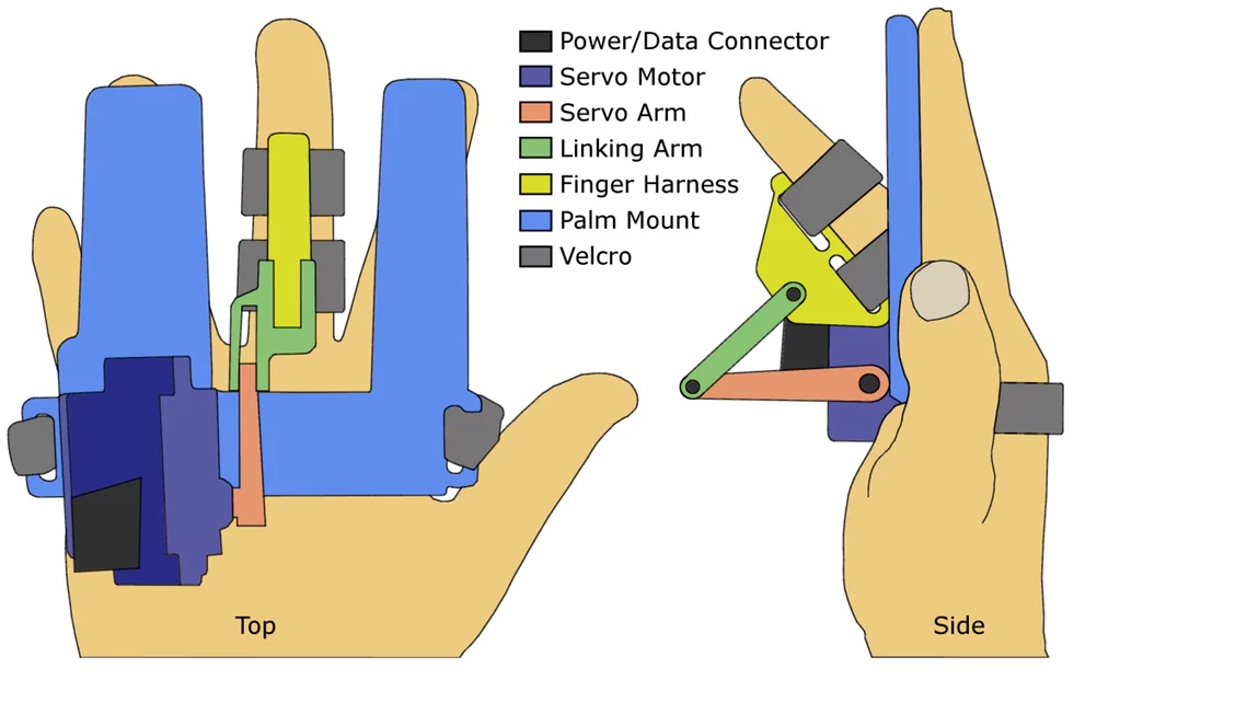 Yeni parmak aparatı Parkinson'u tespit edebilecek