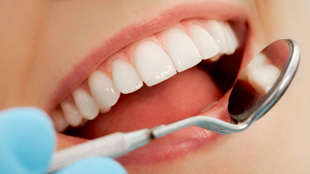 Bağışıklık hücrelerinin de dişleri çürütebileceği tespit edildi