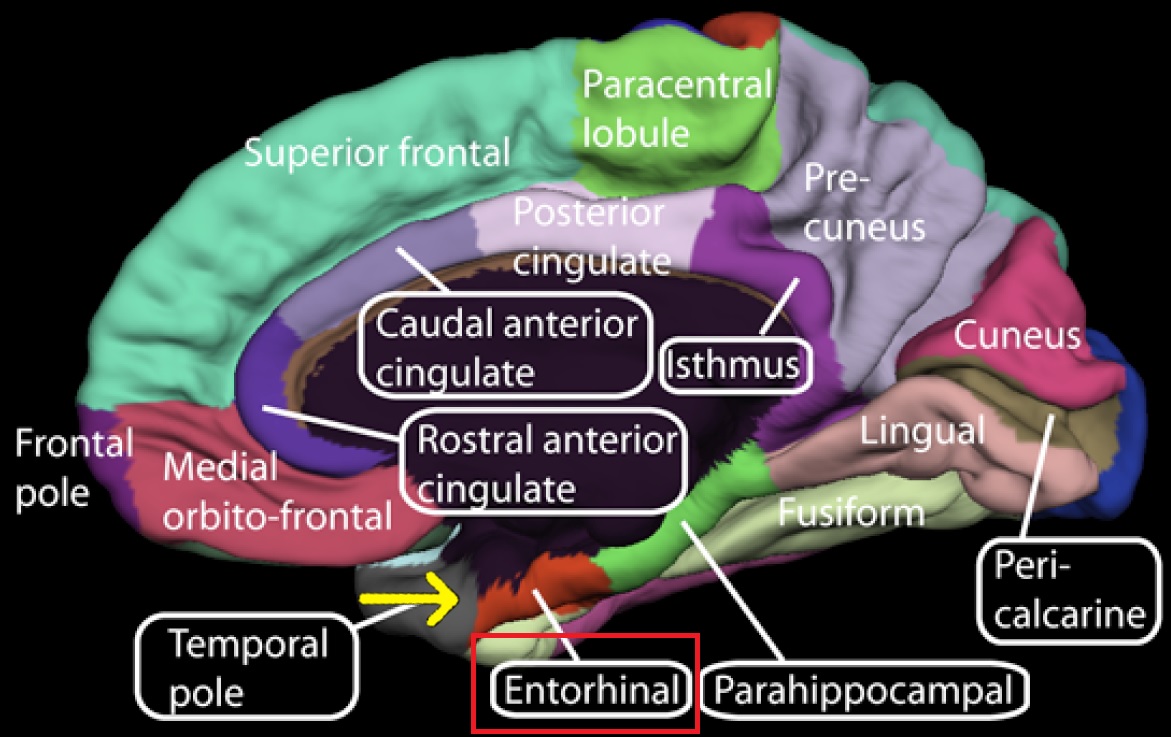 Sanal gerçeklik ile Alzheimer teşhisi kolaylaşacak