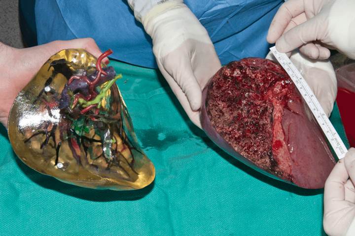 Cerrahlar uc boyutlu organ baskilari uzerinde pratik yapiyor111900 0