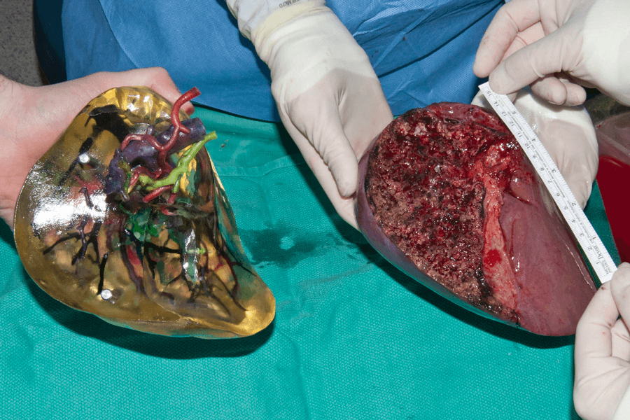 Cerrahlar üç boyutlu organ baskıları üzerinde pratik yapıyor