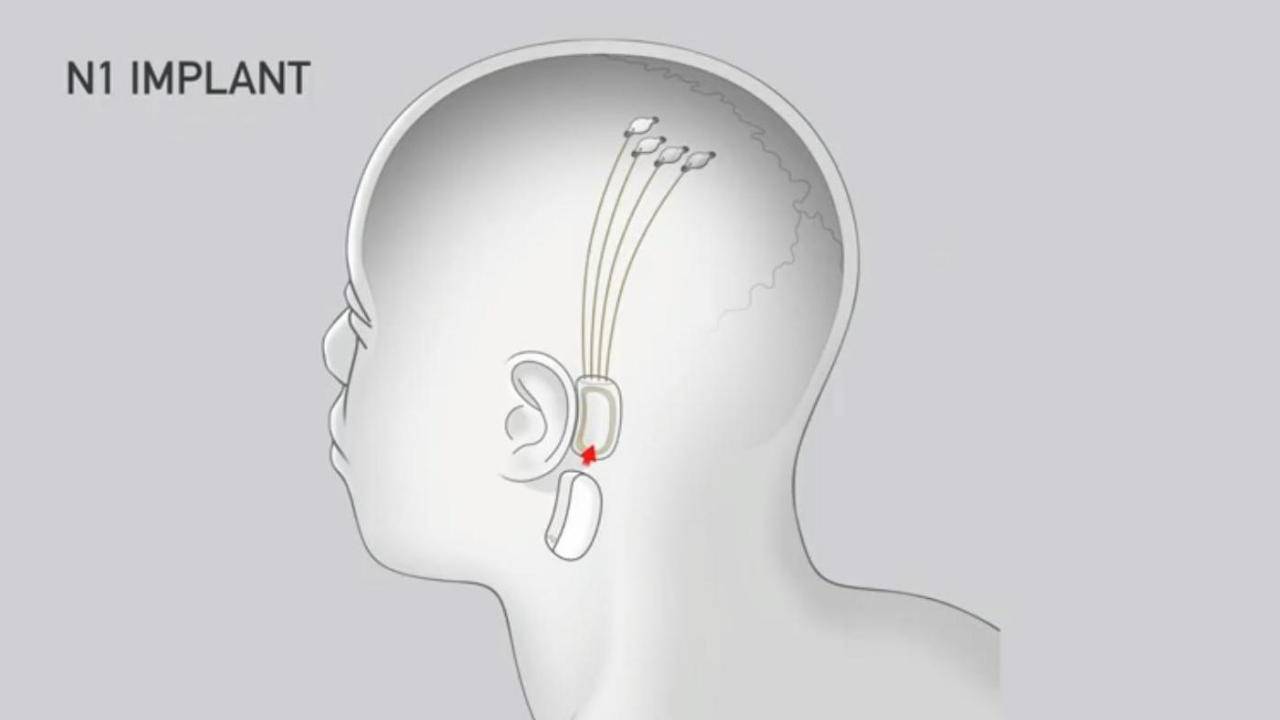 Elon Musk, “Neuralink” sayesinde insan beyni ile bilgisayarları birleştirmeyi hedefliyor