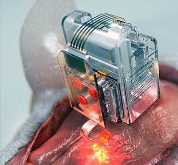 İlaç kartuşları içeren yeni beyin implantı geliştirildi