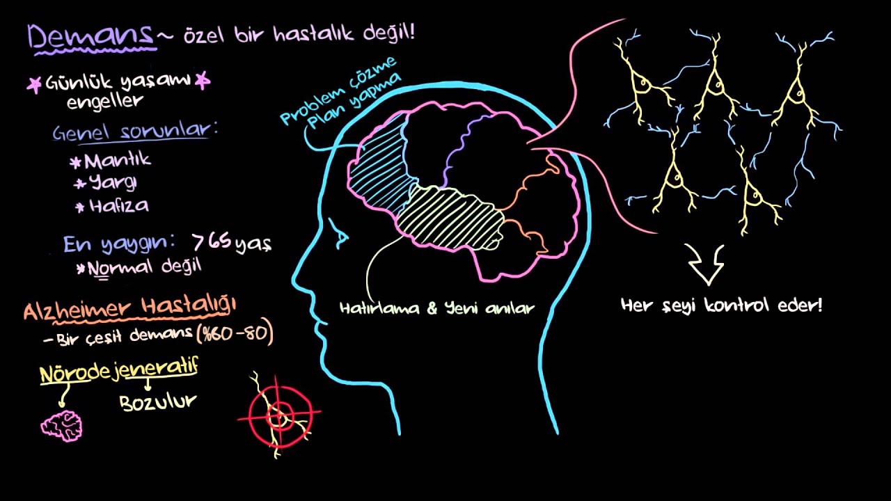 Alzheimer ile ilgili epigenetik belirteçler keşfedildi