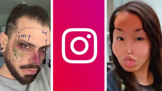 Instagram, plastik cerrahi sonrasını gösteren filtrelerini kaldırıyor