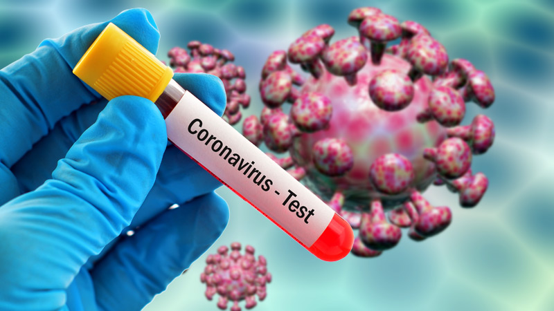 Koronavirüs tesptini hızlandıracak test setleri dağıtıma çıkıyor