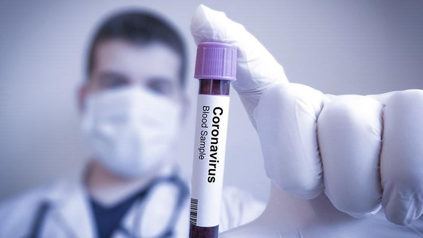 Koronavirüs salgınında bir günde 1000 yeni vaka geldi