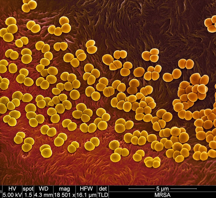 Antibakteriyel bakır plaka üretildi