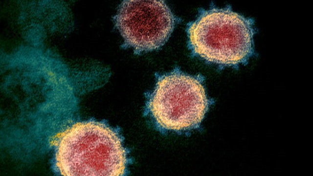 ABD’li Sorrento, koronavirüsü %100 olarak durduran antikor bulduğunu iddia etti