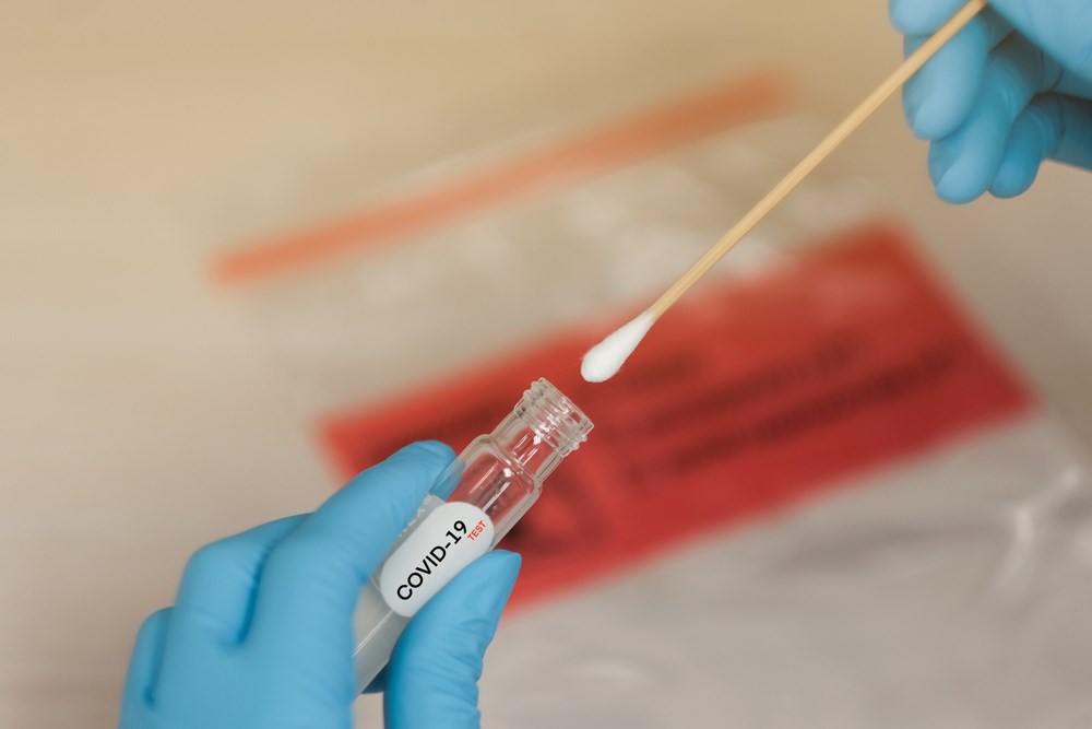 Bakan Koca 'rastgele' yapılan koronavirüs tarama testi sonuçlarını açıkladı