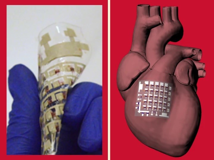 Enerjisini kalbin kasılma gücünden alan implant geliştirildi