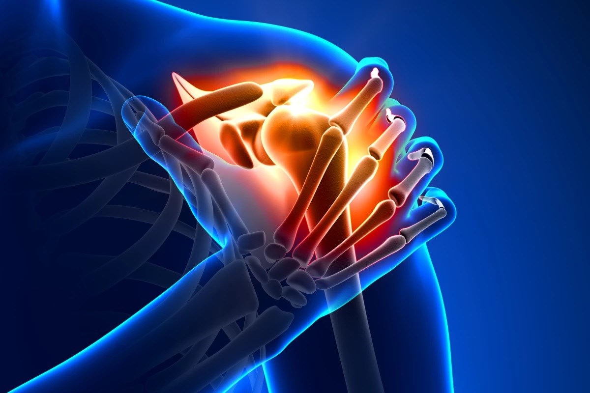 Radyofrekans ablasyon osteoartrit tedavisinde kullanılabilir