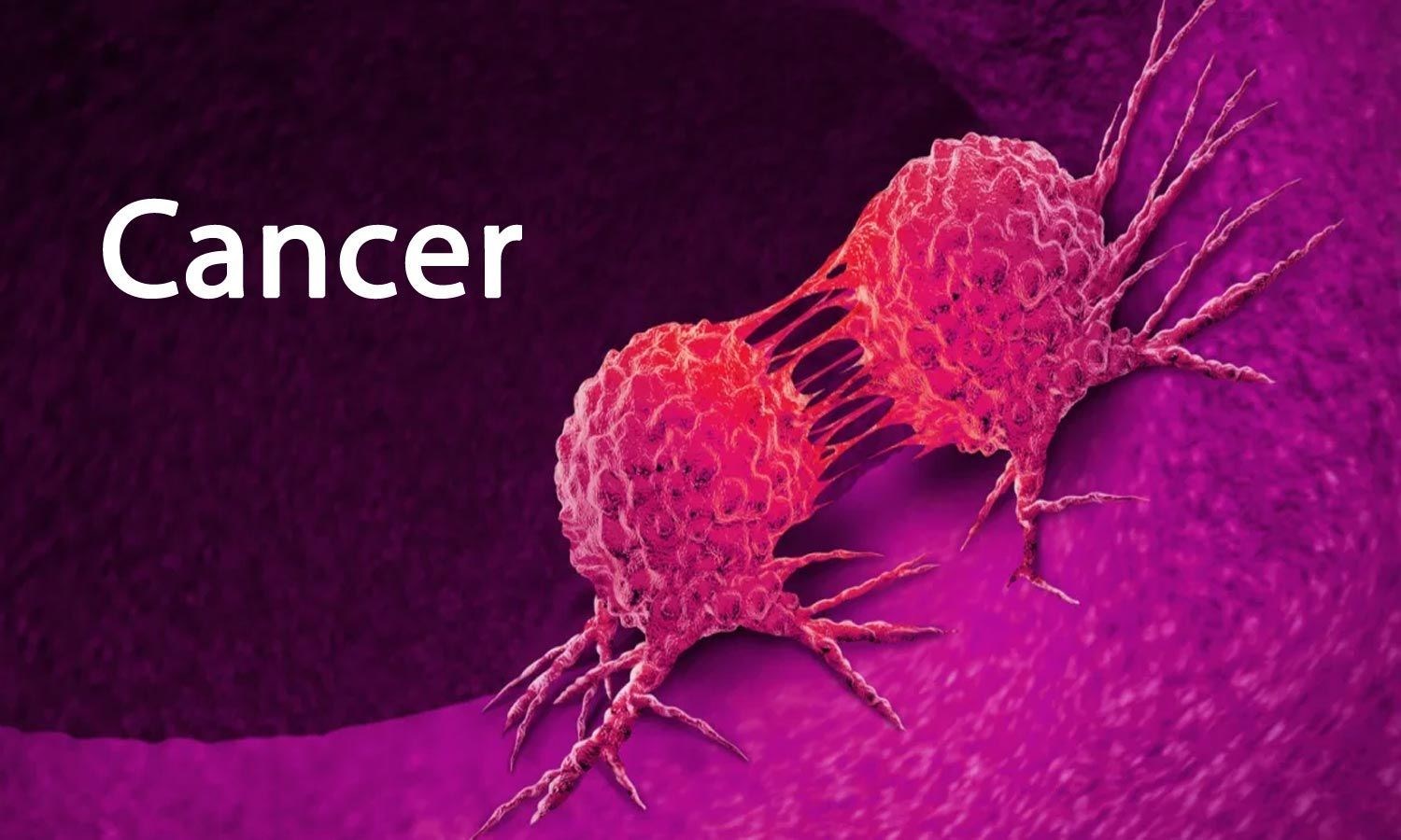 Kanser hücrelerinin kemoterapinin etkilerinden kaçış mekanizması incelendi
