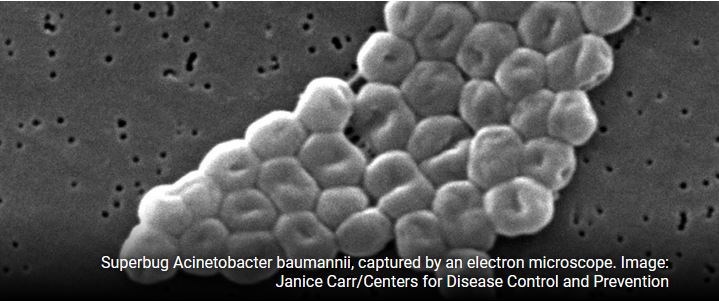 Antibiyotik direncine sahip bakteriyel enfeksiyonlar fajlarla tedavi edilebilir