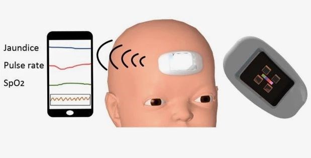 Yenidoğan sarılığı için prototip cihaz geliştirildi