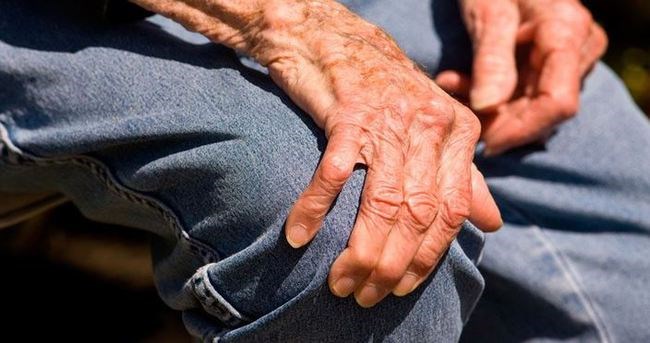 Parkinson hastalığının tedavisinde yeni gelişme