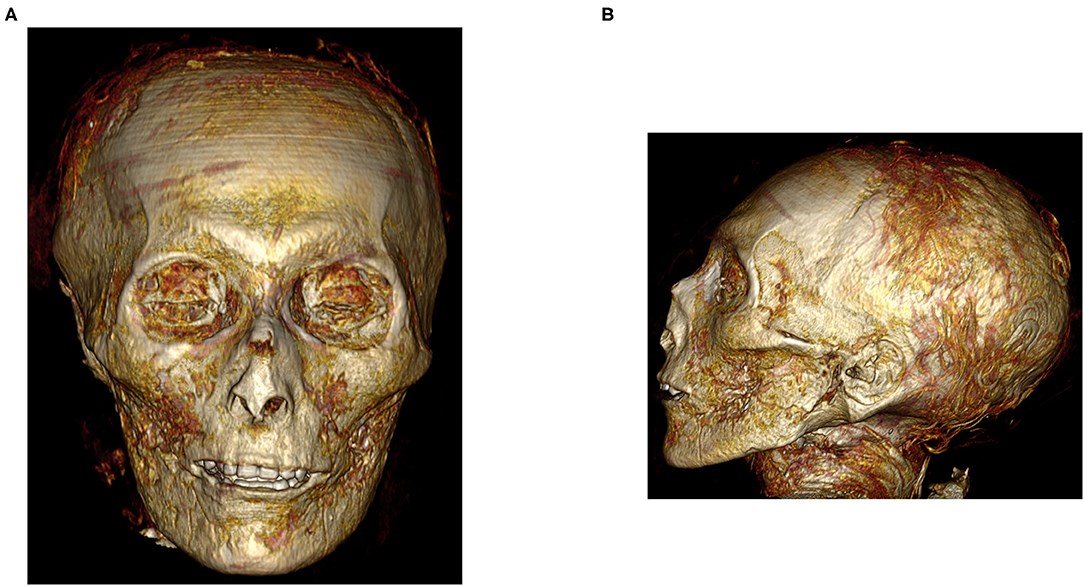 Mısır firavunu I. Amenhotep'in mumyası dijital olarak incelendi