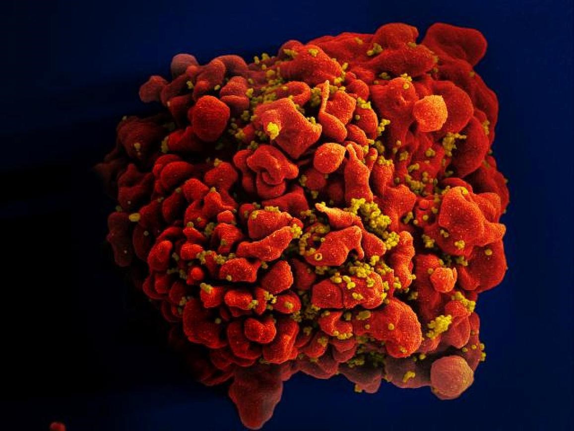 Moderna, 3 farklı mRNA HIV aşısının Faz 1 denemelerine başladı
