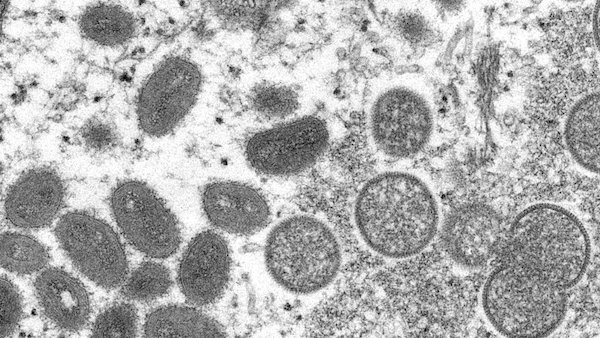 Maymun Çiçeği virüsü mikroskop görüntüsü