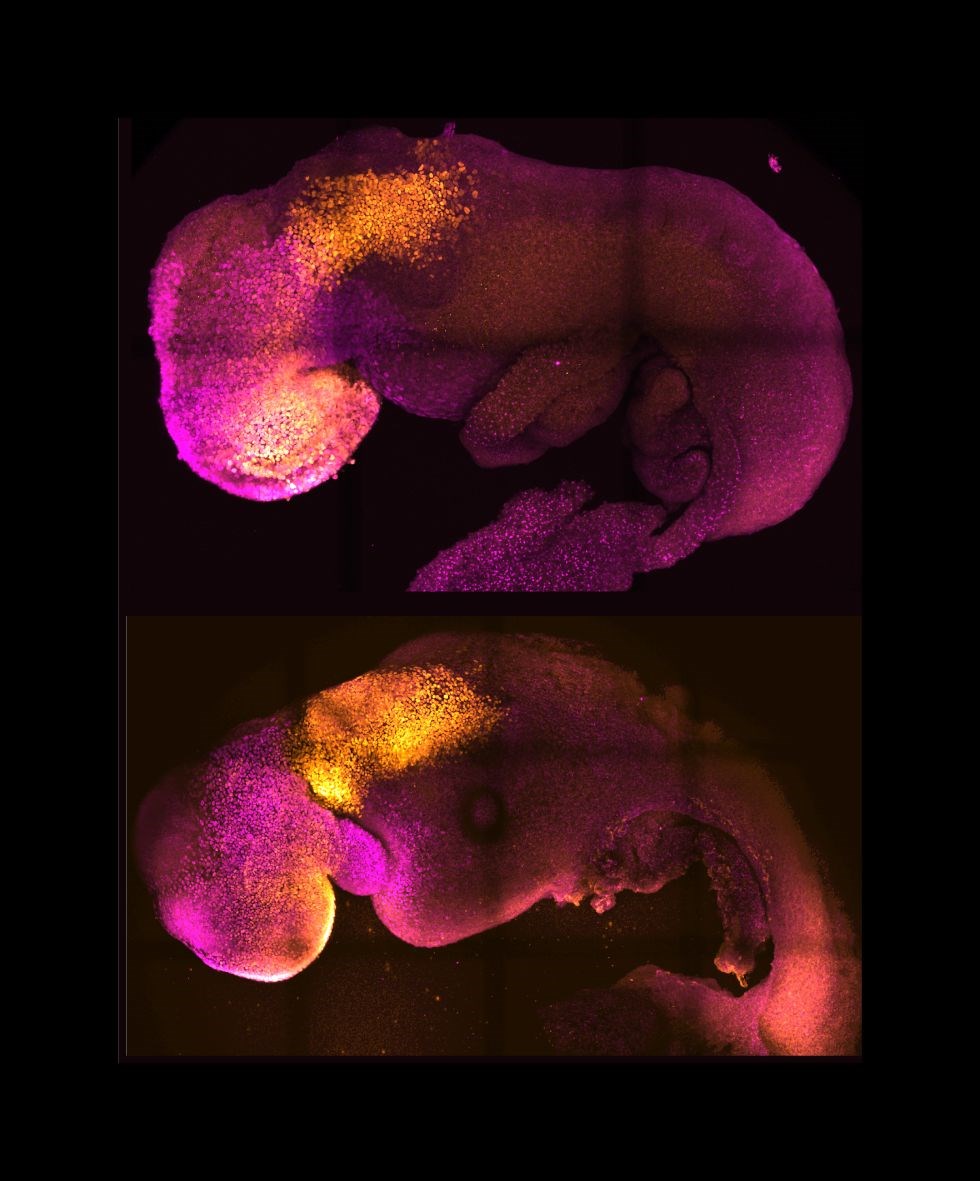 Çığır açan bir gelişmeyle sentetik insan embriyoları oluşturuldu