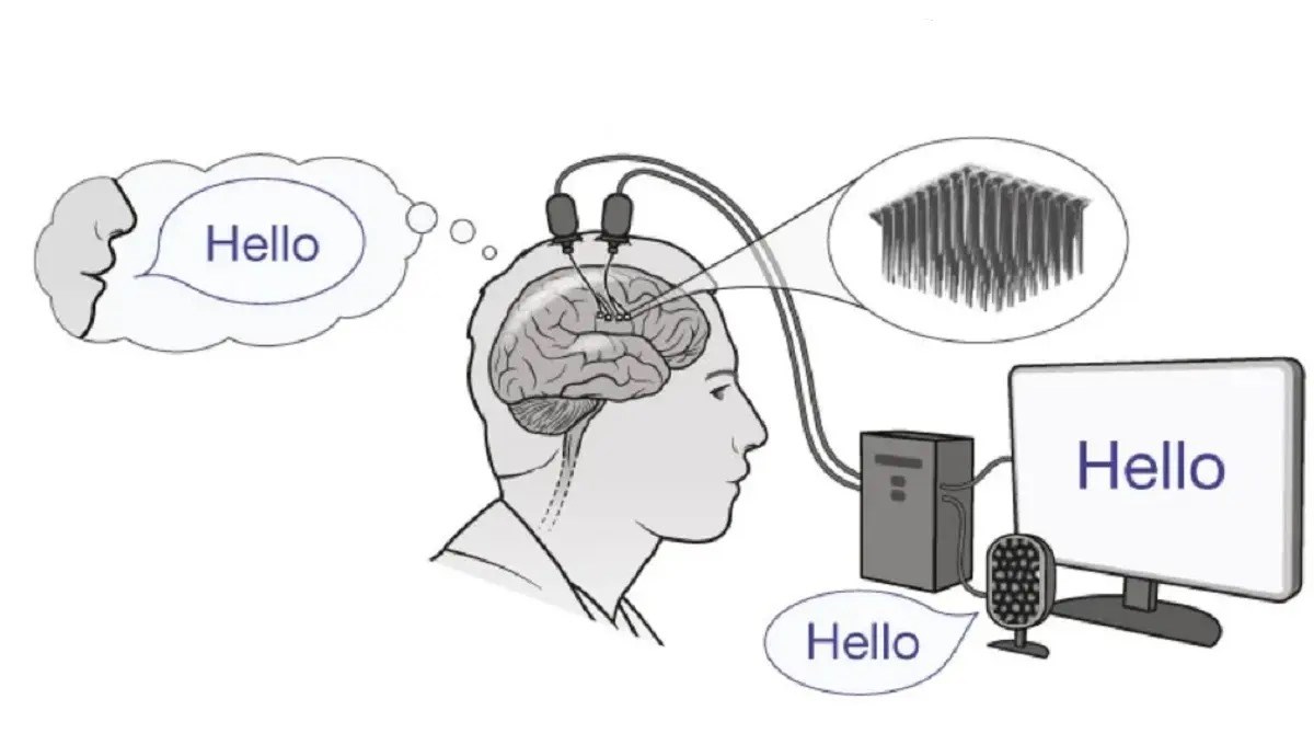 Yeni beyin implantı felçli hastaların iletişimini kolaylaştıracak