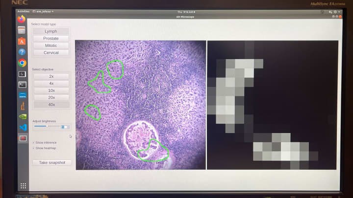 Google Kanser Tespiti Icin Yapay Zekali Mikroskop Gelistiriyor168970 2