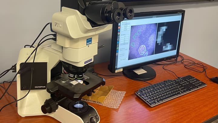 Google Kanser Tespiti Icin Yapay Zekali Mikroskop Gelistiriyor168970 3